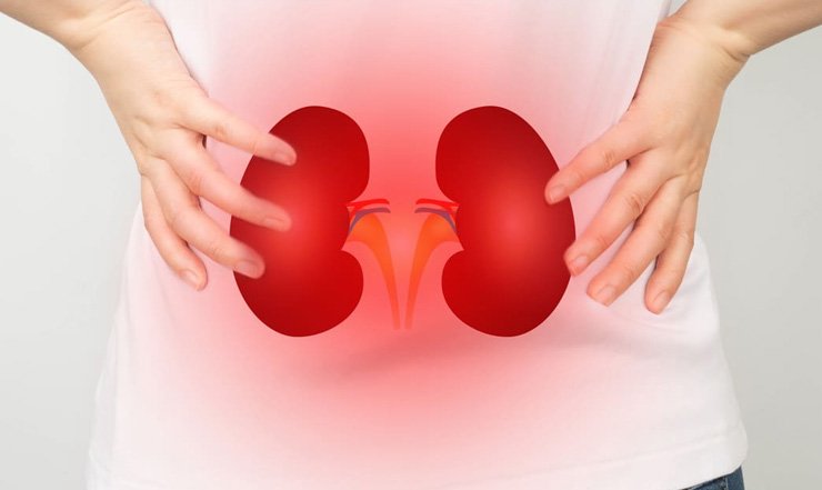 When Your Kidneys Can't Keep Up: Renal Failure