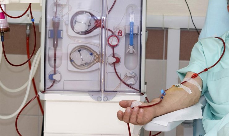 When Your Kidneys Need a Helping Hand: Understanding Dialysis